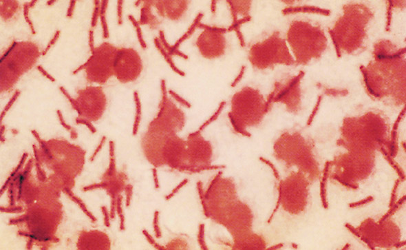 Abbildung 1: Gramfärbung von Bacillus anthracis Grampositive Milzbrandbazillen in einem Austrich von peripheren Blut eines Rhesusaffen der an Lungenmilzbrand gestorben ist. Nachdruck mit Genehmigung von Zajtchuk and Bellamy.